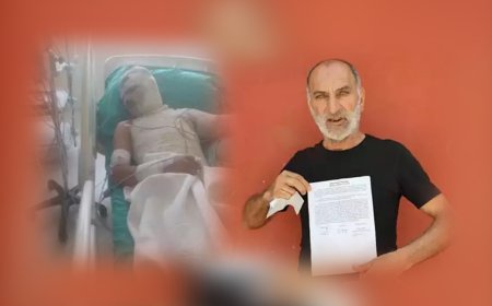 Amca Dehşeti! 16 Yaşındaki Yeğenini Benzinle Yaktı, Suçu Ağabeyine Attı