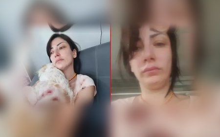 Bursa’da Dehşet Anları: Kangal Saldırısına Uğrayan Kadın ve Köpeği Kanlar İçinde Kaldı