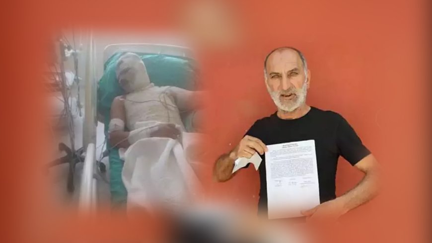 Amca Dehşeti! 16 Yaşındaki Yeğenini Benzinle Yaktı, Suçu Ağabeyine Attı