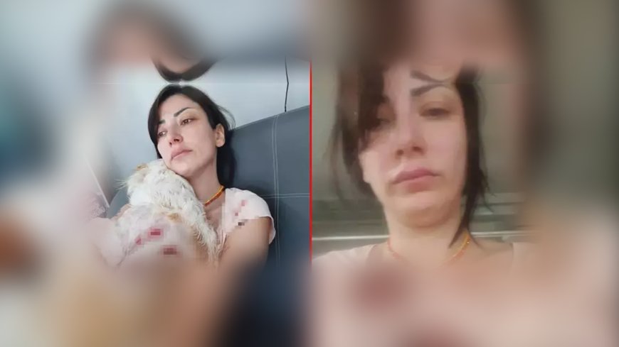 Bursa’da Dehşet Anları: Kangal Saldırısına Uğrayan Kadın ve Köpeği Kanlar İçinde Kaldı