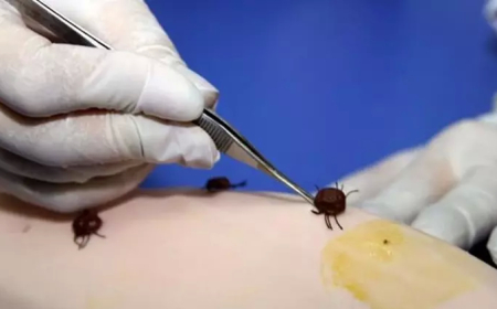 Joe Rogan’dan Şok İddia: “Lyme Hastalığı Biyolojik Silah Olabilir”