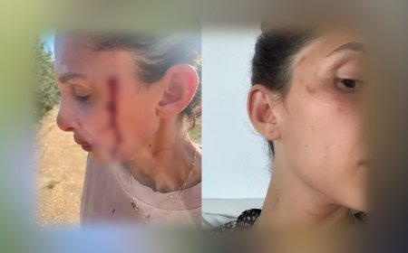 Can Yaman’ın Sevgilisi Sara Bluma’dan Kanlar İçinde Şok Paylaşım: “Şiddet Görüyorum”