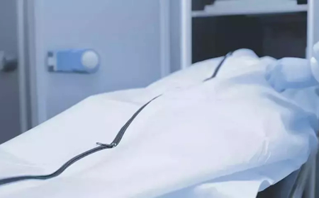 Ölü İlan Edilen Adam 30 Dakika Sonra Gözlerini Açtı: Doktorları Şoke Eden Lazarus Vakası