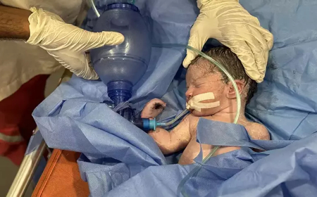 Gazze’de Hava Saldırısı: Hamile Kadın Hayatını Kaybetti, Bebeği Son Anda Kurtarıldı