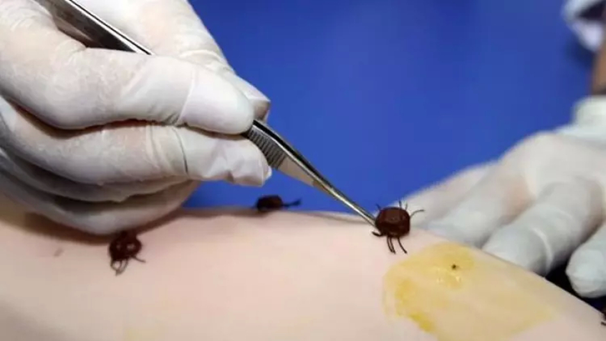 Joe Rogan’dan Şok İddia: “Lyme Hastalığı Biyolojik Silah Olabilir”