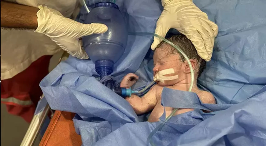 Gazze’de Hava Saldırısı: Hamile Kadın Hayatını Kaybetti, Bebeği Son Anda Kurtarıldı