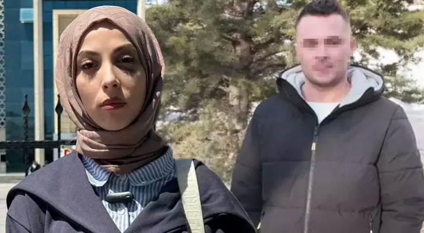 Eski Eşinin Şiddetine Uğradı, Delil Sundu: Şimdi Kendisi Hakkında Soruşturma Açıldı