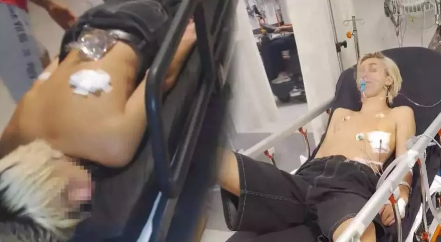 Kuşadası’nda Ukrayna Uyruklu Çocuk Parkta Bıçaklandı