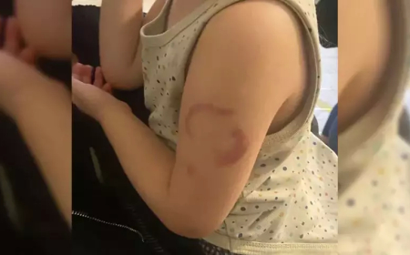 Edirne’de Özel Kreşte “Isırılma” İddiası: Baba Şikayetçi Oldu