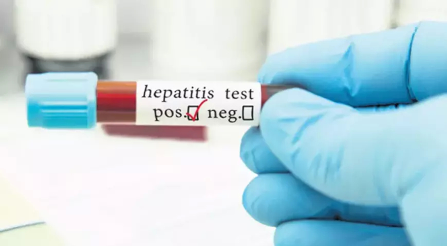 Sağlık Bakanlığı’ndan Yeni Hedef: 2030’a Kadar “Hepatitsiz Türkiye”