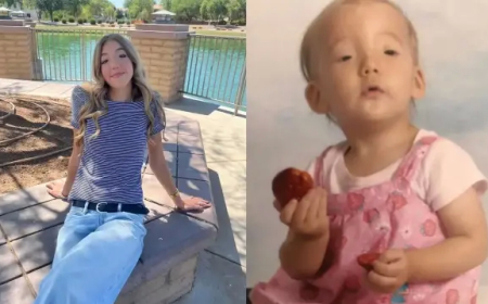 Doğuştan Göz Kırpamıyordu, Ameliyatla Başardı: Hikâyesi Dünyayı Etkiledi