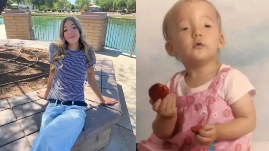 Doğuştan Göz Kırpamıyordu, Ameliyatla Başardı: Hikâyesi Dünyayı Etkiledi