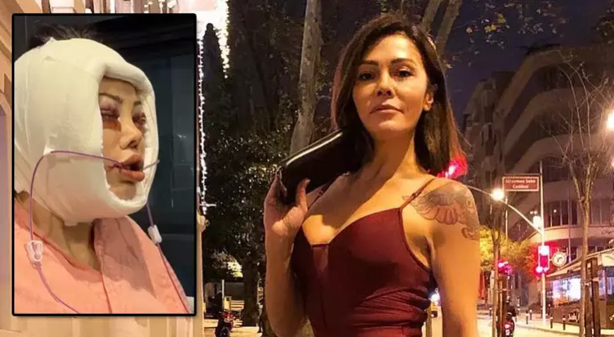 Kore’de yüz nakli olmuştu: Didem Ceran hastalığını açıkladı