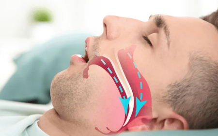 Uyku Apnesinde Yeni Bir Umut: İlaçlı Tedavi Yolda