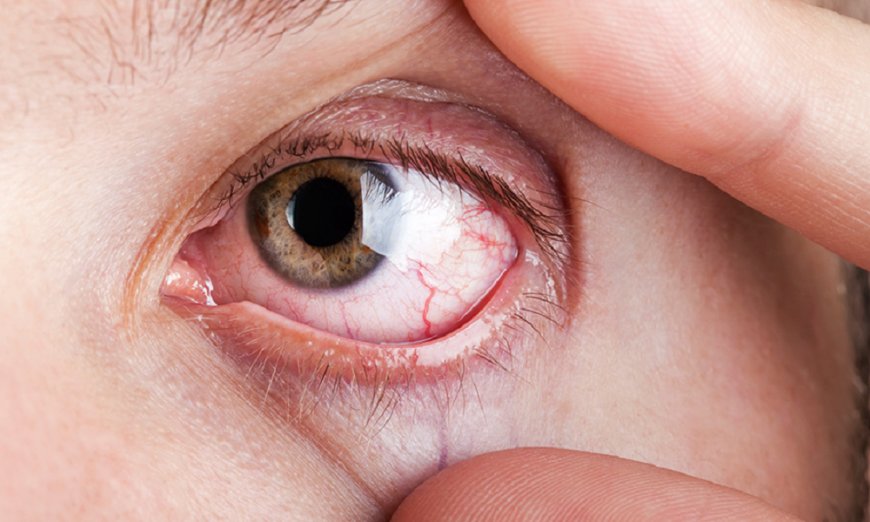 Glokomda erken teşhis körlüğün yüzde 90’ını önleyebiliyor