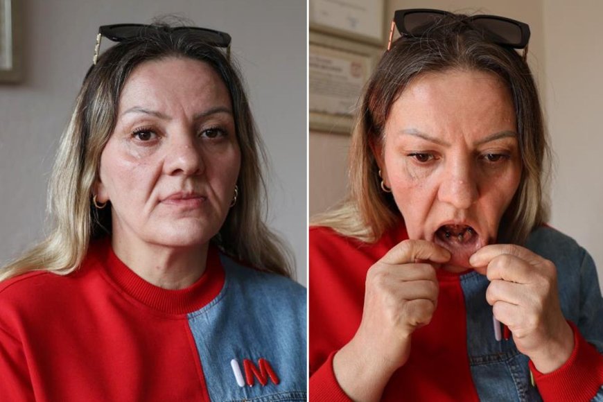 Diş Ağrısıyla Gitti, Hayatı Karardı: 25 Dişinden Oldu, 36 Çeyrek Altın Harcadı